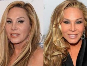 Adrienne Maloof before and afterplastic surgery (41)