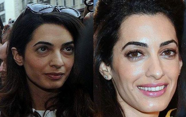 Amal Clooney before and after plastic surgery