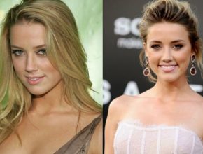 Amber Heard before and after plastic surgery (35)