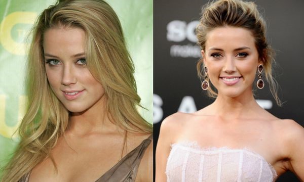 Amber Heard before and after plastic surgery (35) .