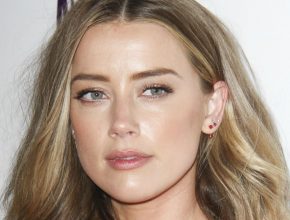 Amber Heard plastic surgery (11)