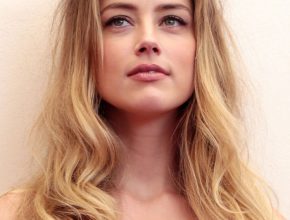 Amber Heard plastic surgery (16)