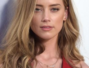 Amber Heard plastic surgery (2)