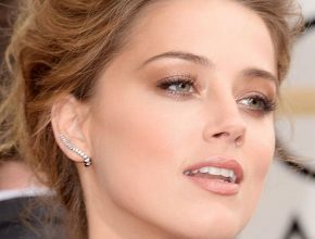 Amber Heard plastic surgery (21)