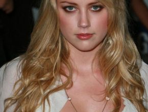 Amber Heard plastic surgery (45)