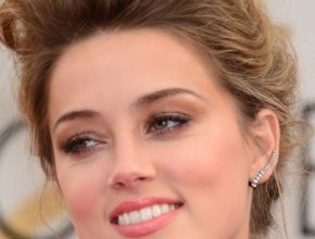 Amber Heard plastic surgery (5)