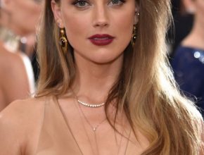 Amber Heard plastic surgery (8)