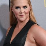 Amy Schumer plastic surgery (2)