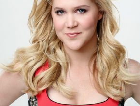 Amy Schumer plastic surgery (25)