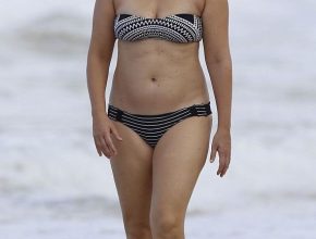 Amy Schumer plastic surgery (32)