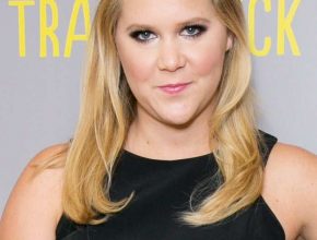 Amy Schumer plastic surgery (37)