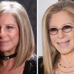 Barbra Streisand before and after plastic surgery (25)