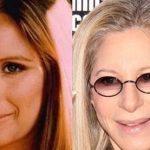 Barbra Streisand before and after plastic surgery (3)