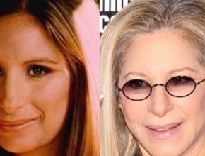 Barbra Streisand before and after plastic surgery (3)