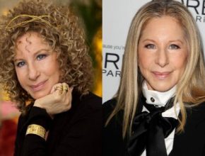 Barbra Streisand before and after plastic surgery