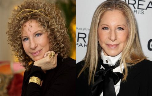 Barbra Streisand before and after plastic surgery