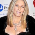 Barbra Streisand plastic surgery (20)