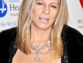 Barbra Streisand plastic surgery (20)