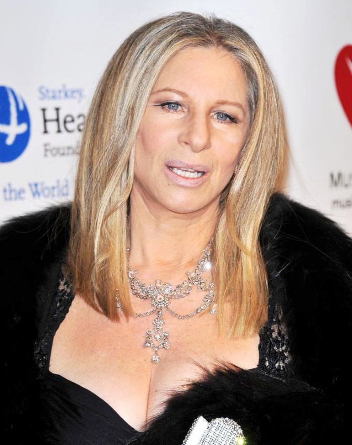 Barbra Streisand plastic surgery (20) Celebrity plastic