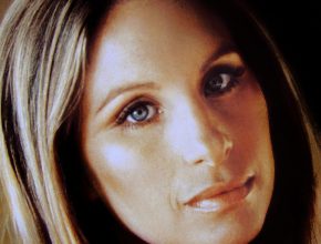 Barbra Streisand plastic surgery (31)