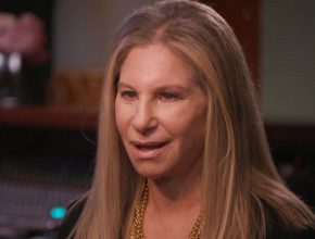 Barbra Streisand plastic surgery (34)