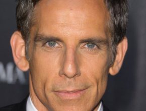 Ben Stiller plastic surgery (01)