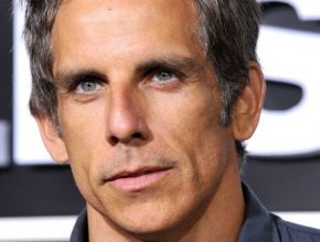 Ben Stiller plastic surgery (10)