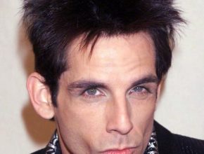 Ben Stiller plastic surgery (2)