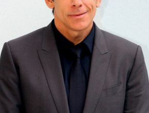 Ben Stiller plastic surgery (29)