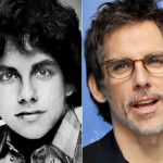 Ben Stiller before and after plastic surgery (32)