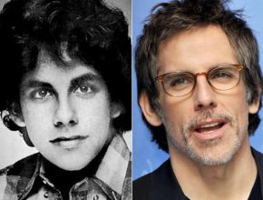 Ben Stiller before and after plastic surgery (32)