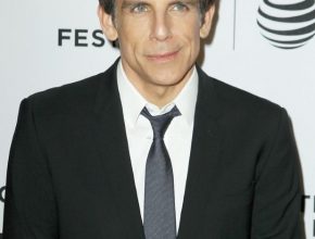 Ben Stiller plastic surgery (4)