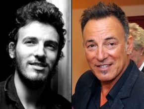 Bruce Springsteen before and after plastic surgery (1)