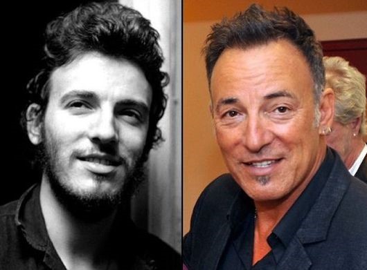Bruce Springsteen before and after plastic surgery