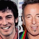 Bruce Springsteen before and after plastic surgery (23)