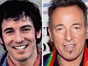 Bruce Springsteen before and after plastic surgery (23)