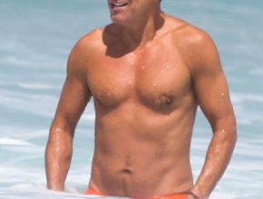 Bruce Springsteen plastic surgery (36)