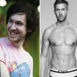 Calvin Harris before and after plastic surgery (16)