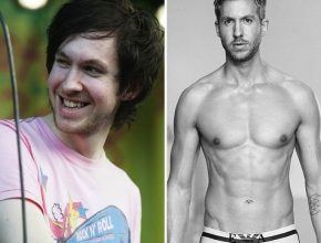 Calvin Harris before and after plastic surgery (16)