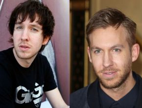 Calvin Harris before and after plastic surgery