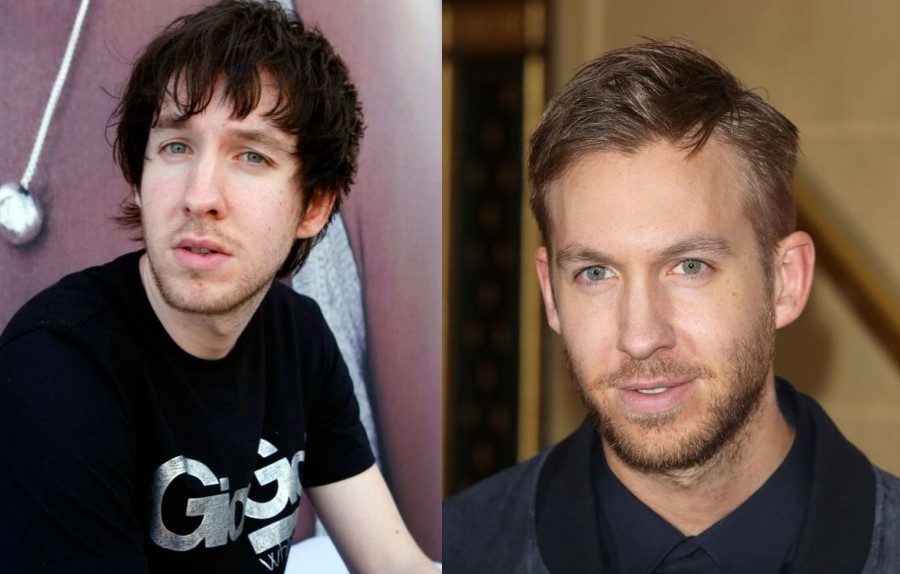 Calvin Harris before and after plastic surgery