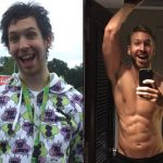 Calvin Harris before and after plastic surgery (28)