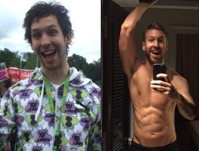 Calvin Harris before and after plastic surgery (28)