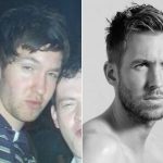 Calvin Harris before and after plastic surgery (35)