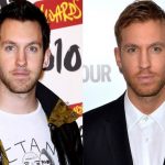 Calvin Harris before and after plastic surgery (6)