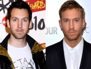 Calvin Harris before and after plastic surgery (6)