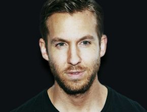 Calvin Harris plastic surgery (19)