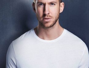 Calvin Harris plastic surgery (24)