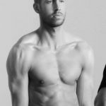 Calvin Harris plastic surgery (5)