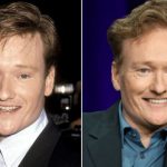 Conan O'Brien before and after plastic surgery (1)